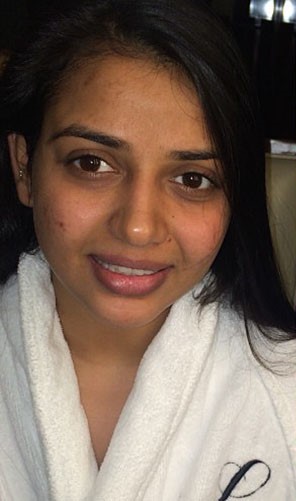 Before Facial Radiance